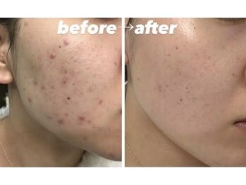 スリリアン 銀座/★お客さまビフォーアフター★