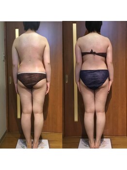 プリンセス バイ セイフティプリンセス 長野店(PRINCESS)/筋膜リリース×全身痩身【2】