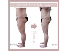 アイナ(aina)の雰囲気（マシーンと手技の足ケアメニューとホームケアアドバイスで美脚に）