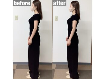 イロハ鍼灸整骨院 豊中市役所前院(IroHa鍼灸整骨院)/姿勢&可動域&柔軟性向上