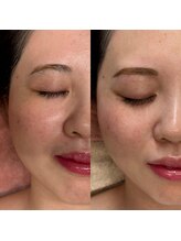 ニナ コレクション 那覇おもろまち店(Nina collection)/つるもちフェイスワックス