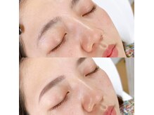 アイブロウサロン WHITEEYE 福岡博多 眉毛専門店 【ホワイトアイ】の雰囲気(フェイスwaxでつるんと卵肌に♪アイブロウスタイリング×顔脱毛)