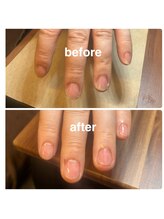 メンズネイルビズ 赤坂(Men's Nail Biz)/MOIST　PRO｜温熱密封リペア