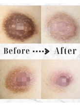 Yui Clear Skin/ヴィーナスピンク