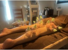 エステティックサロン ビエラブ(bierabu)/【オプション】脚カッピング