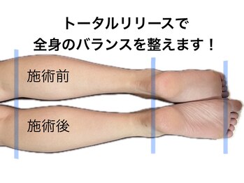 ボディエステ ルビー(Ruby)の写真/癒されながら整える♪頭から身体の先までケアし若々しい見た目へ◎ボディライン・小顔バランス調整お任せ◎