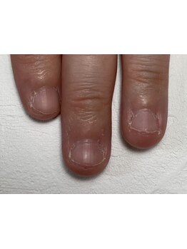 爪の悩みを解消できる（ケア含む）