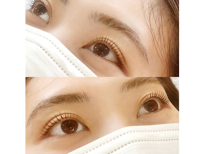 ハナナ(hanana)の写真