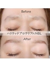 アール(R.)/ハリウッドブロウリフト