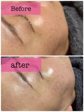 アスピリア(aspirer a')/タイムロックプログラム