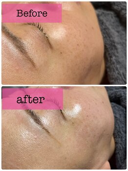 アスピリア(aspirer a')/タイムロックプログラム