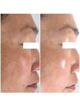 ボディメイキング キキ(Bodymaking KIKI)/視界がひろがる