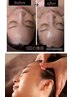 【再来】ダクトピール「顔＋首」＆極上ドライヘッドスパ¥14000→¥13000