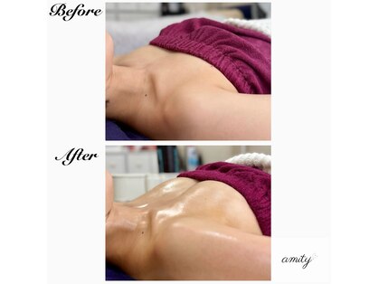 アミティ(amity)の写真