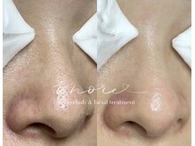 モア(MORE)の雰囲気（認定済ライセンスサロン/症例はインスタに多数掲載@maho_keana）