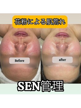 インチャント 四万十店(enchant)/花粉にも負けない肌作り!