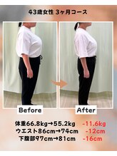 くさば整骨院/43歳女性/ダイエット3か月コース
