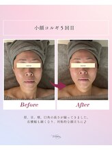 ヴィオルネ(VIE ORNER)/