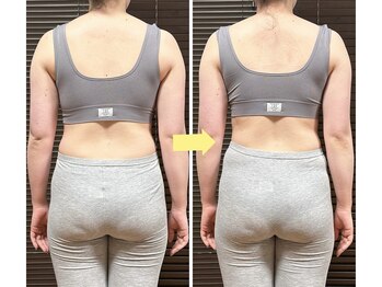 たけのこの写真/【新規の方お得☆30代産後の美意識向上に】女性特有の骨盤の歪みケア50分6000円