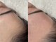 ジャスミー(jasmy)の写真/都度払いok◎今大注目のフェイスワックス脱毛で毎日のスキンケアの質を底上げ!