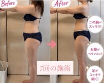 ヨサパーク ルポ(YOSA PARK ropos)