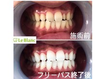 ルブラン 奈良店(Le Blanc)/笑顔をより一層引き立ててくれる
