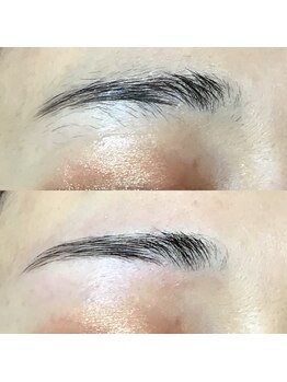 ツナミ(Tsunami)/眉毛脱毛