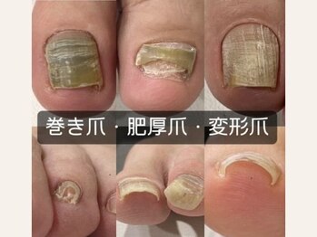 爪屋ソウジロウ(SOJIRO)