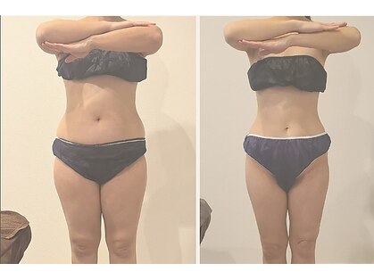 まこトレ スリムラボ(SLIMELABO)の写真