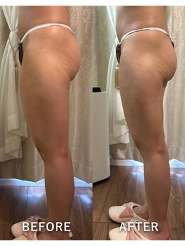 サロンハート(Salon Heart)/