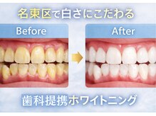 エランホワイトニング 一社店