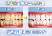 エランホワイトニング 一社店