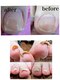 ルリアン(Le Lien)の写真/痛い巻き爪卒業】巻き爪・陥入爪補正ケア