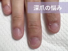 アメジスト(Amethyst)