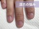 アメジスト(Amethyst)の写真/深爪・噛み爪・爪のお悩み専門サロン！コンプレックスを解消し、人前で自信を持って出せる指先へ