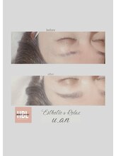 ユアン(u.an)/ハリウッドブロウリフト