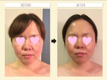 ハピア(HappiA)/小顔コルギ