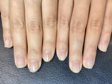 アンドネイル 海老名(&nail)/深爪さん★After