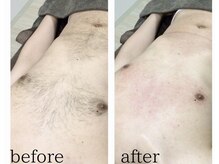 ラヴィアンクレール 梅田店(La vie en Clair)/◆前面ワックス脱毛◆