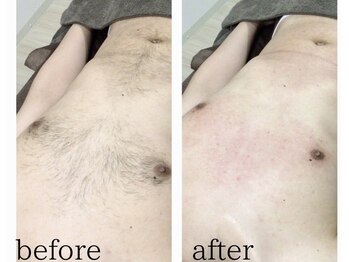 ラヴィアンクレール 梅田店(La vie en Clair)/◆前面ワックス脱毛◆