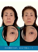 ハリラボ(hari Lab.)/【お客様の声】