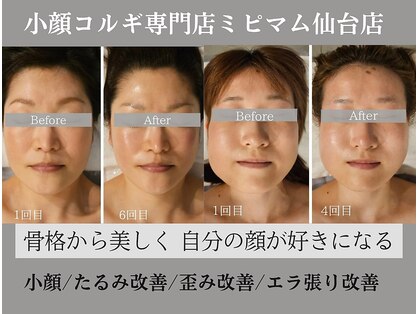 ミピマムマール(Mipimam Maaru)の写真