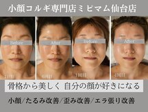 ミピマムマール(Mipimam Maaru)