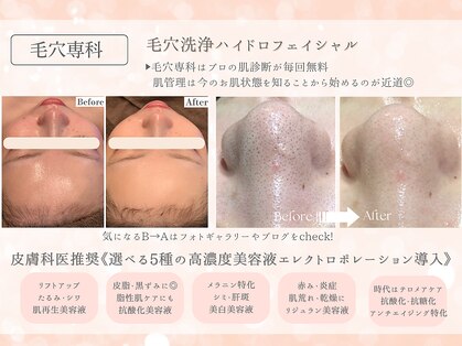 フレイヤ(FREYA)の写真