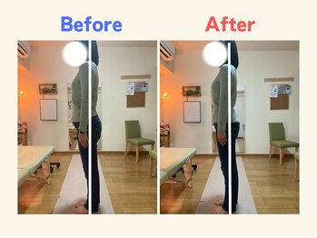 ピース/反り腰が気になる40代女性