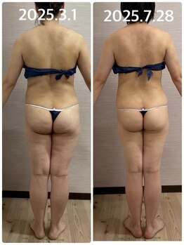 ソフィア わさだ店/セルゼロ2全身コース