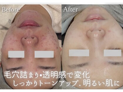 ルミエール 札幌大通parkside店の写真