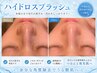【ニキビ肌向け♪】ハイドロ洗浄デコルテリンパ付70分♪¥16500→¥5500