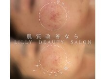 リリー(LILLY)の雰囲気（予約殺到【海洋源ハーブピーリング】毛穴・ニキビにはこれ！）