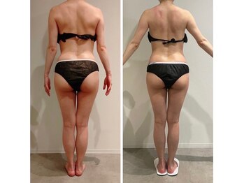 エイジングケアサロン 青山 本店/3種マシン・90分最強痩身!